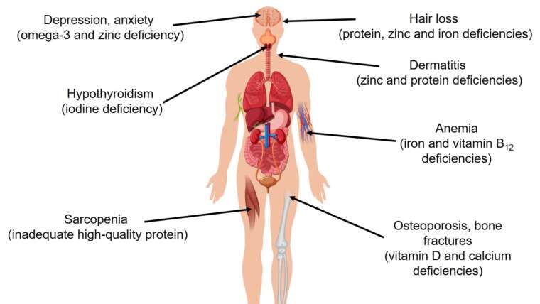 Vegan Health Risks: Understanding and Avoiding Nutritional Deficiencies